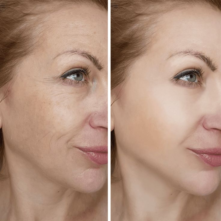 Siero al collagene dorato 24k